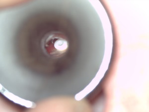 Same patient after tubes